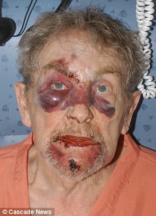 Gordon Glynn, 84, suffered horrific injuries after he was punched by Joseph Dickinson